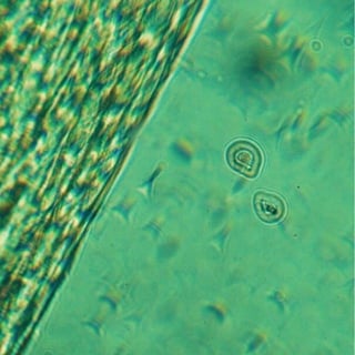 Biomineral complex