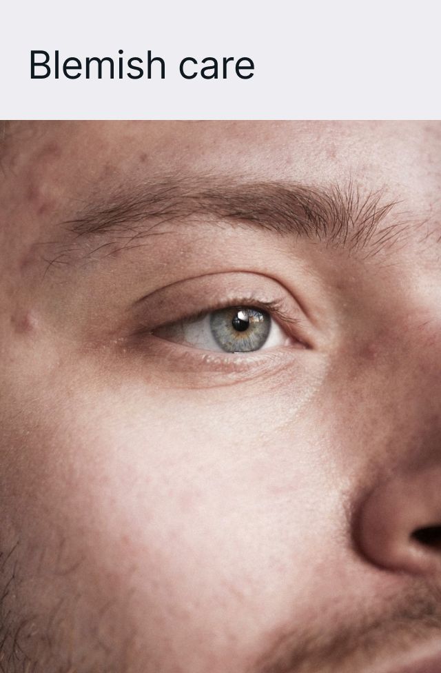 Acne Care Moisturiser, detail 8