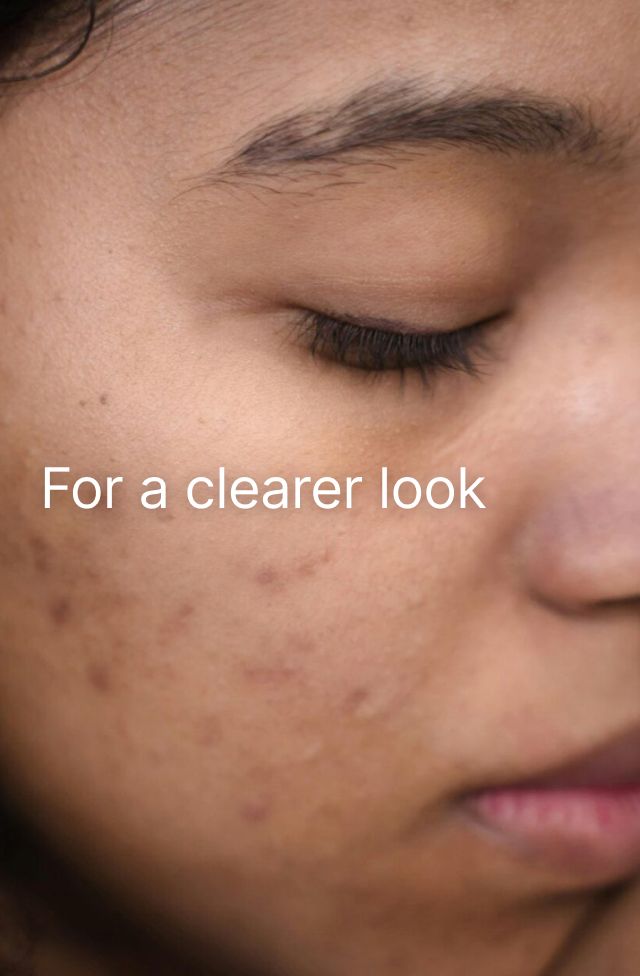 Acne Purifying Face Wash, detail 8