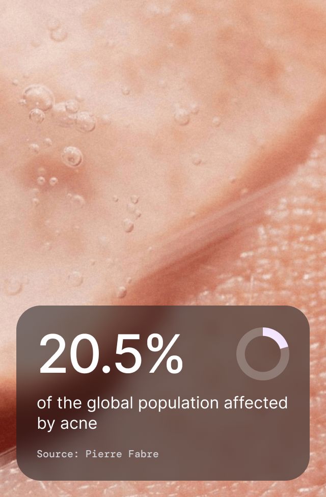 Acne Purifying Face Wash, detail 4
