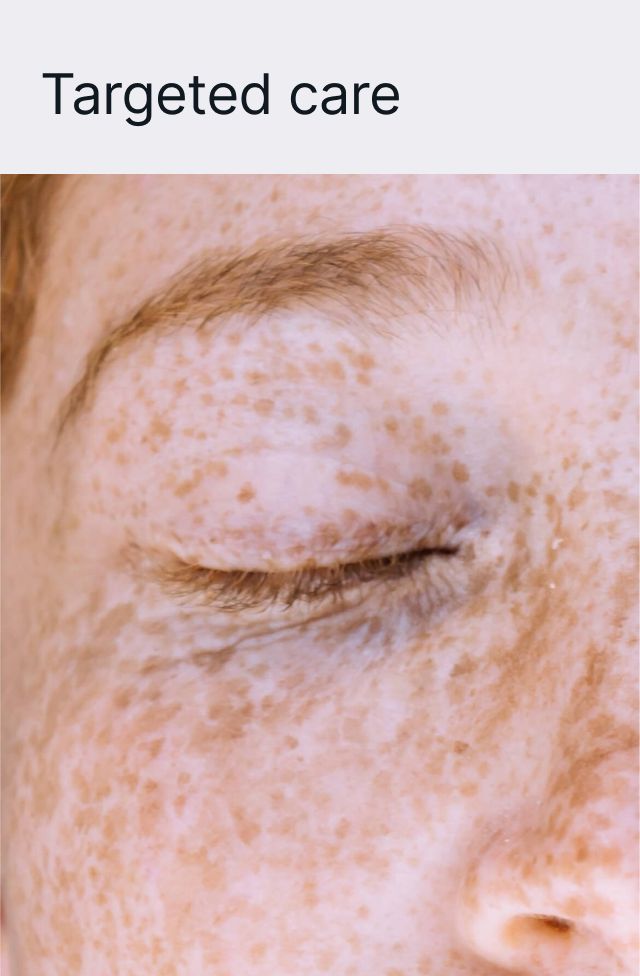 Dark Spot Face Cream with Kojic Acid, detail 3