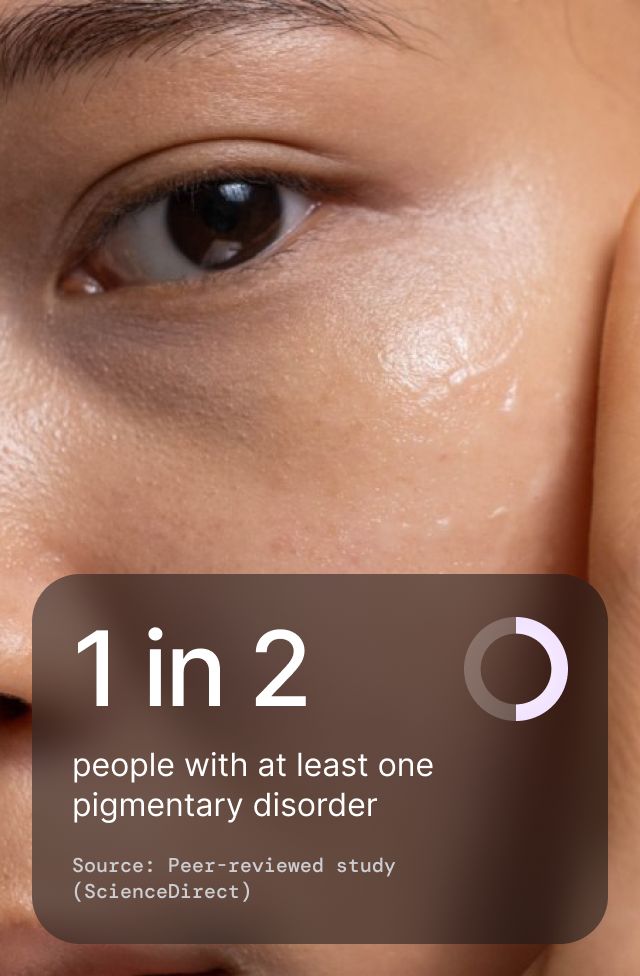 Targeted Dark Spot Care, 1% Kojic Acid, detail 4