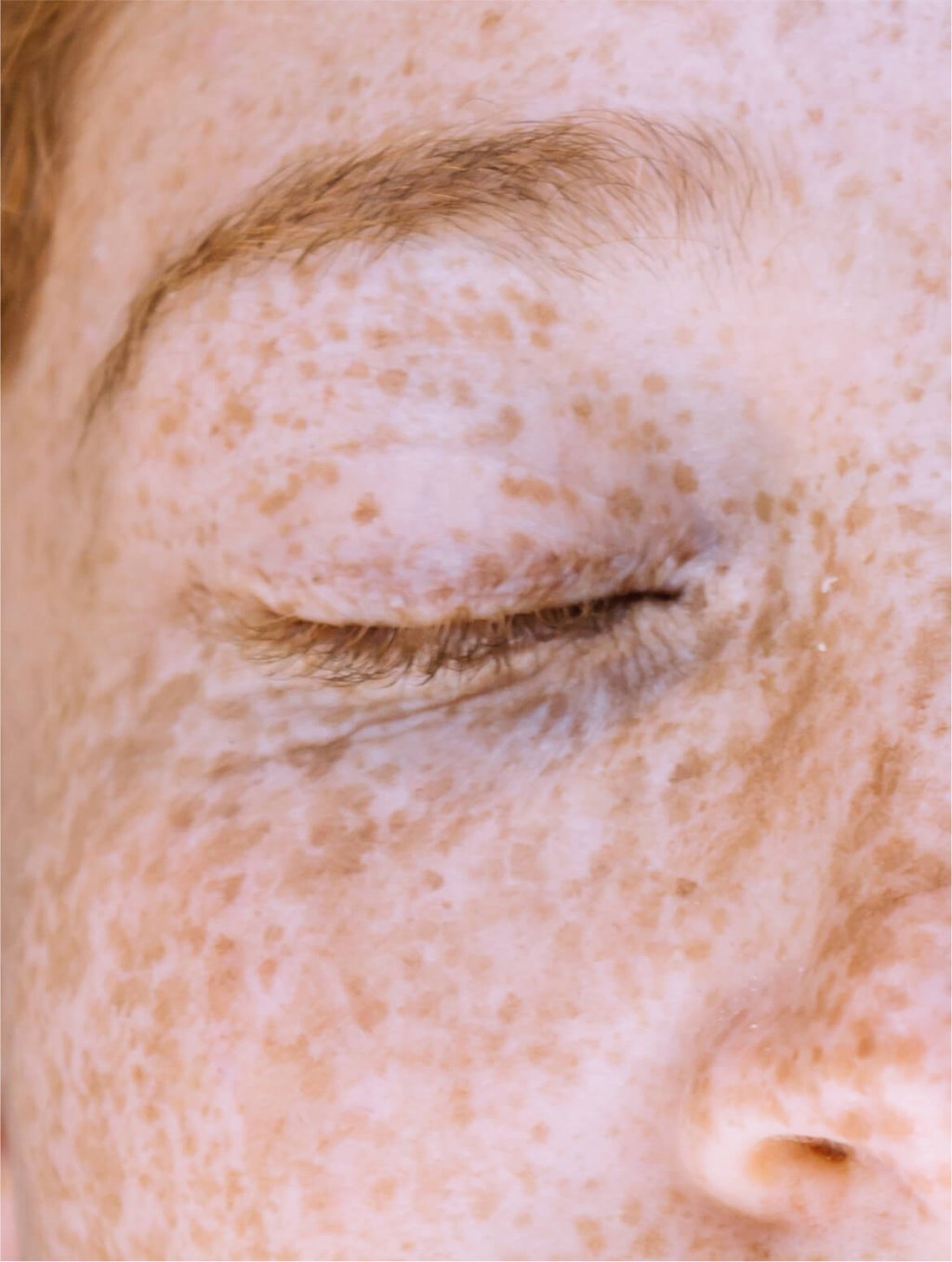 Dark Spot Face Cream with Kojic Acid in use