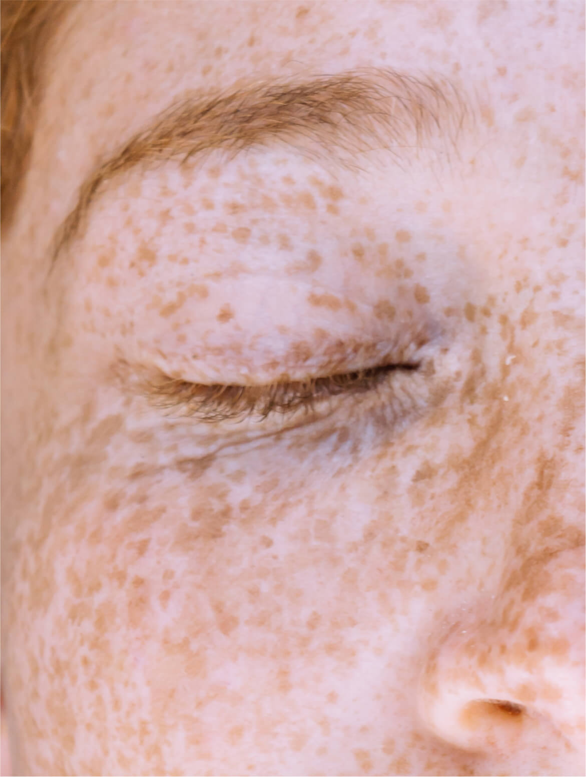Dark Spot Face Cream with Kojic Acid in use