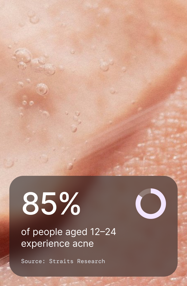 Acne Spot Care, detail 4